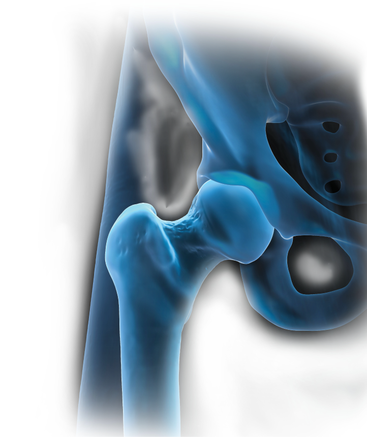 X-ray hip background