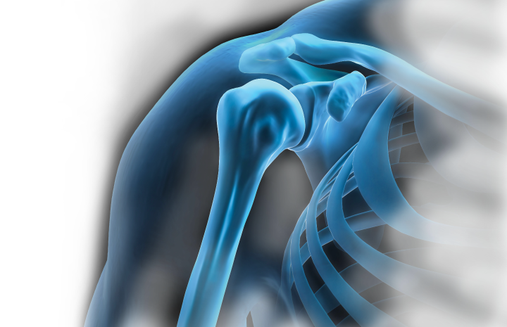 X-ray Shoulder Background